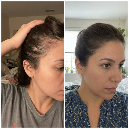 Hair Regrowth Gummies