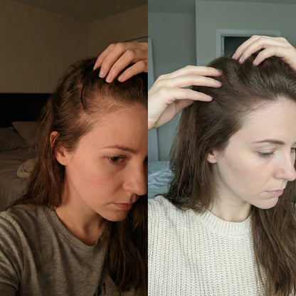 Hair Regrowth Gummies